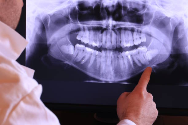 Best Emergency Treatment for Dental Infections or Abscesses in Brockport, NY